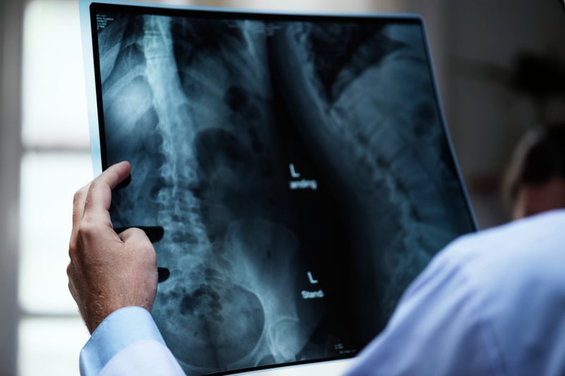 X-rays being analyzed by a doctor